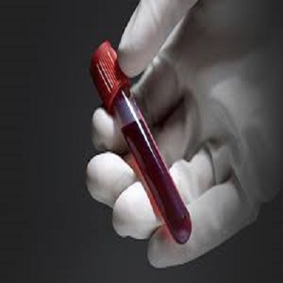 Blood Test in Dubai - Everything You Need to Know